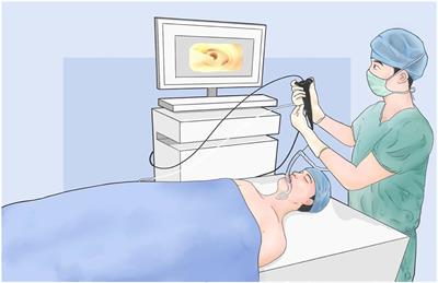 Electromagnetic Navigation Bronchoscopy Integrated Non-intubated Uniportal VATS in Localization and Resection of Pulmonary Nodules